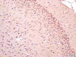 SAP102/DLG3 Antibody in Immunohistochemistry (Paraffin) (IHC (P))