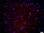 CPLX1 Antibody in Immunohistochemistry (Paraffin) (IHC (P))