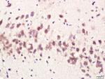 CPLX1 Antibody in Immunohistochemistry (Paraffin) (IHC (P))