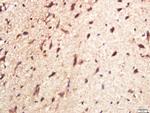 CPLX1 Antibody in Immunohistochemistry (Paraffin) (IHC (P))