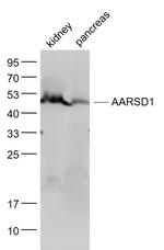 AARSD1 Antibody in Western Blot (WB)