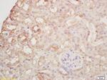 Arginase 2 Antibody in Immunohistochemistry (Paraffin) (IHC (P))