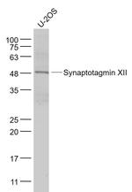 Synaptotagmin 12 Antibody in Western Blot (WB)