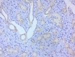 STAT2 Antibody in Immunohistochemistry (Paraffin) (IHC (P))