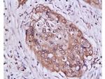 STAT3 Antibody in Immunohistochemistry (Paraffin) (IHC (P))