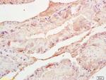 Adrenodoxin Antibody in Immunohistochemistry (Paraffin) (IHC (P))