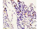 STAT6 Antibody in Immunohistochemistry (Paraffin) (IHC (P))