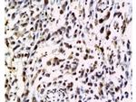 NRAS Antibody in Immunohistochemistry (Paraffin) (IHC (P))