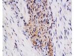 TSLC1 Antibody in Immunohistochemistry (Paraffin) (IHC (P))