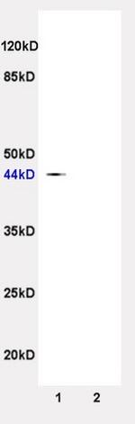 TSLC1 Antibody in Western Blot (WB)