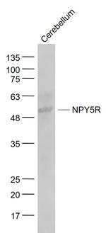 NPY5R Antibody in Western Blot (WB)