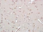 Gelsolin Antibody in Immunohistochemistry (Paraffin) (IHC (P))