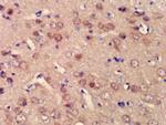 BPTF/FALZ Antibody in Immunohistochemistry (Paraffin) (IHC (P))