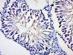 BPTF/FALZ Antibody in Immunohistochemistry (Paraffin) (IHC (P))