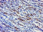 BPTF/FALZ Antibody in Immunohistochemistry (Paraffin) (IHC (P))