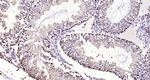 BPTF/FALZ Antibody in Immunohistochemistry (Paraffin) (IHC (P))