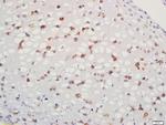 Aggrecan Antibody in Immunohistochemistry (Paraffin) (IHC (P))