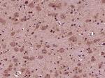 Aggrecan Antibody in Immunohistochemistry (Paraffin) (IHC (P))