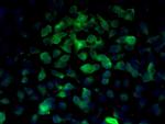 Beta catenin Antibody in Immunocytochemistry (ICC/IF)