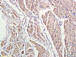 ROCK1 Antibody in Immunohistochemistry (Paraffin) (IHC (P))