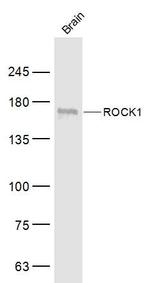 ROCK1 Antibody in Western Blot (WB)