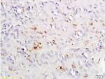 CCR4 Antibody in Immunohistochemistry (Paraffin) (IHC (P))