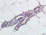 CCR4 Antibody in Immunohistochemistry (Paraffin) (IHC (P))