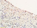 CCR4 Antibody in Immunohistochemistry (Paraffin) (IHC (P))