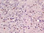 ER81 Antibody in Immunohistochemistry (Paraffin) (IHC (P))