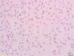 CDKN2A/p19ARF Antibody in Immunohistochemistry (Paraffin) (IHC (P))