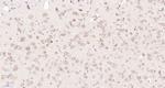 SPG3A/Atlastin Antibody in Immunohistochemistry (Paraffin) (IHC (P))