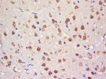 SULT4A1 Antibody in Immunohistochemistry (Paraffin) (IHC (P))