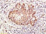 RhoA/C Antibody in Immunohistochemistry (Paraffin) (IHC (P))