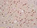 Jarid2/Jumonji Antibody in Immunohistochemistry (Paraffin) (IHC (P))