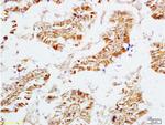 ECE1 Antibody in Immunohistochemistry (Paraffin) (IHC (P))