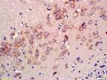 NRG1 Antibody in Immunohistochemistry (Paraffin) (IHC (P))