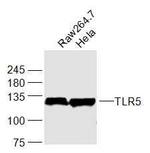 TLR5 Antibody in Western Blot (WB)