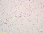 Phosphoserine/threonine/tyrosine Antibody in Immunohistochemistry (Paraffin) (IHC (P))