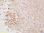 PAX1 Antibody in Immunohistochemistry (Paraffin) (IHC (P))