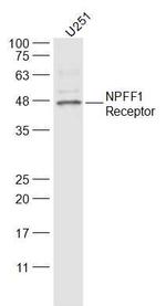 GPR147/NPFF1 Receptor Antibody in Western Blot (WB)