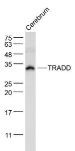 TRADD Antibody in Western Blot (WB)