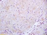 ROCK2 Antibody in Immunohistochemistry (Paraffin) (IHC (P))