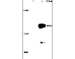 ROCK2 Antibody in Western Blot (WB)