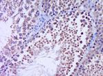 GLI1 Antibody in Immunohistochemistry (Paraffin) (IHC (P))