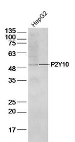 P2Y10 Antibody in Western Blot (WB)