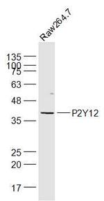 P2Y12 Antibody in Western Blot (WB)