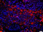 P2Y9 Antibody in Immunohistochemistry (Paraffin) (IHC (P))