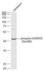 Phospho-GABRG2 (Ser366) Antibody in Western Blot (WB)