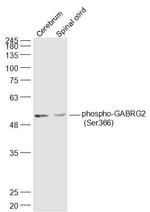 Phospho-GABRG2 (Ser366) Antibody in Western Blot (WB)