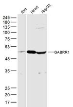 GABRR1 Antibody in Western Blot (WB)